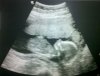 babyboy18weeks.jpg